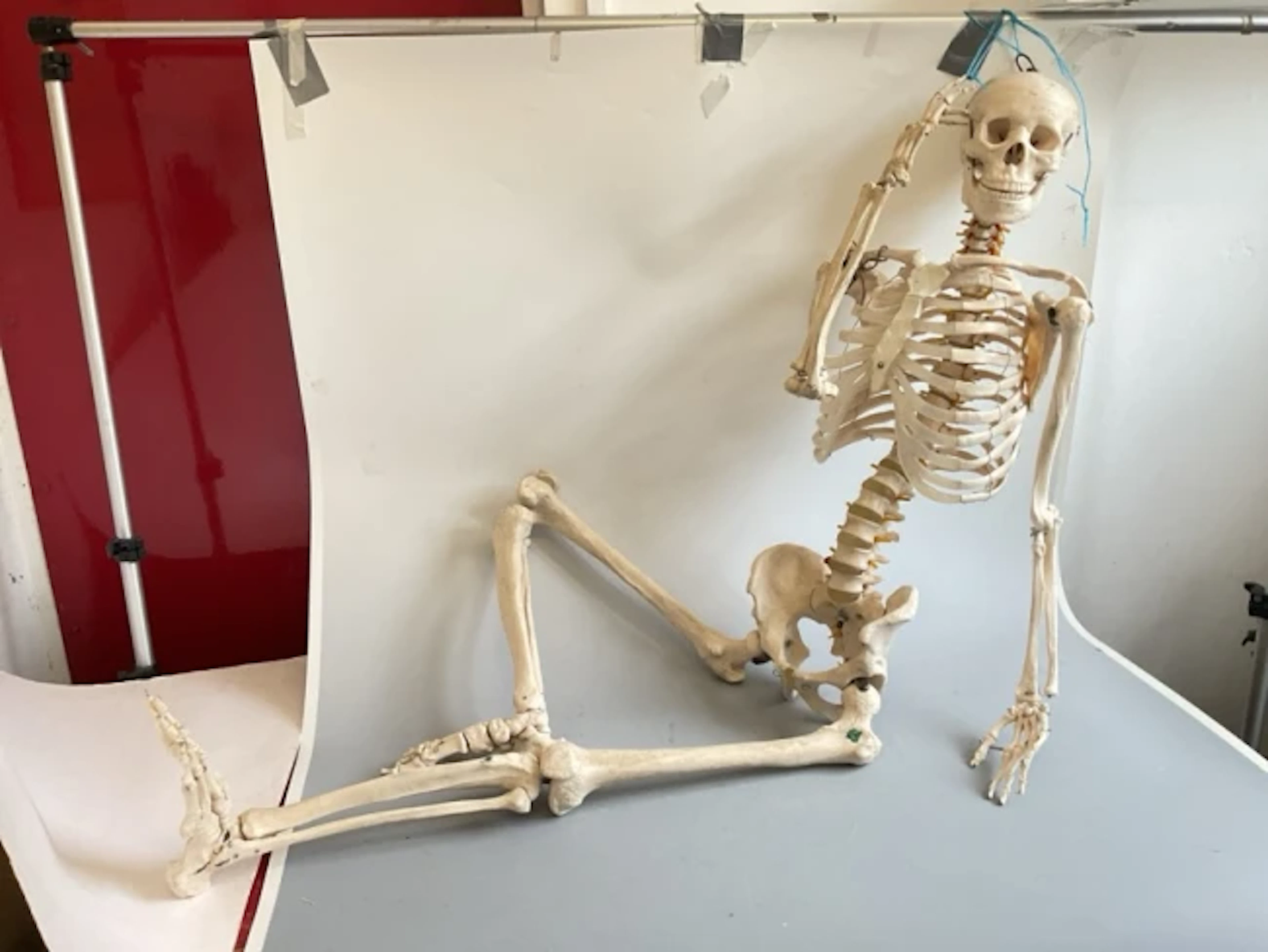 An anatomical skeleton with fully articulated and wired body, skull