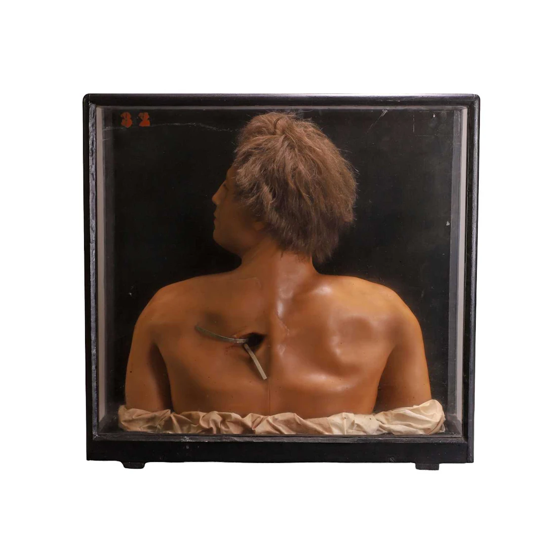 A medical diorama early to mid-20th century
