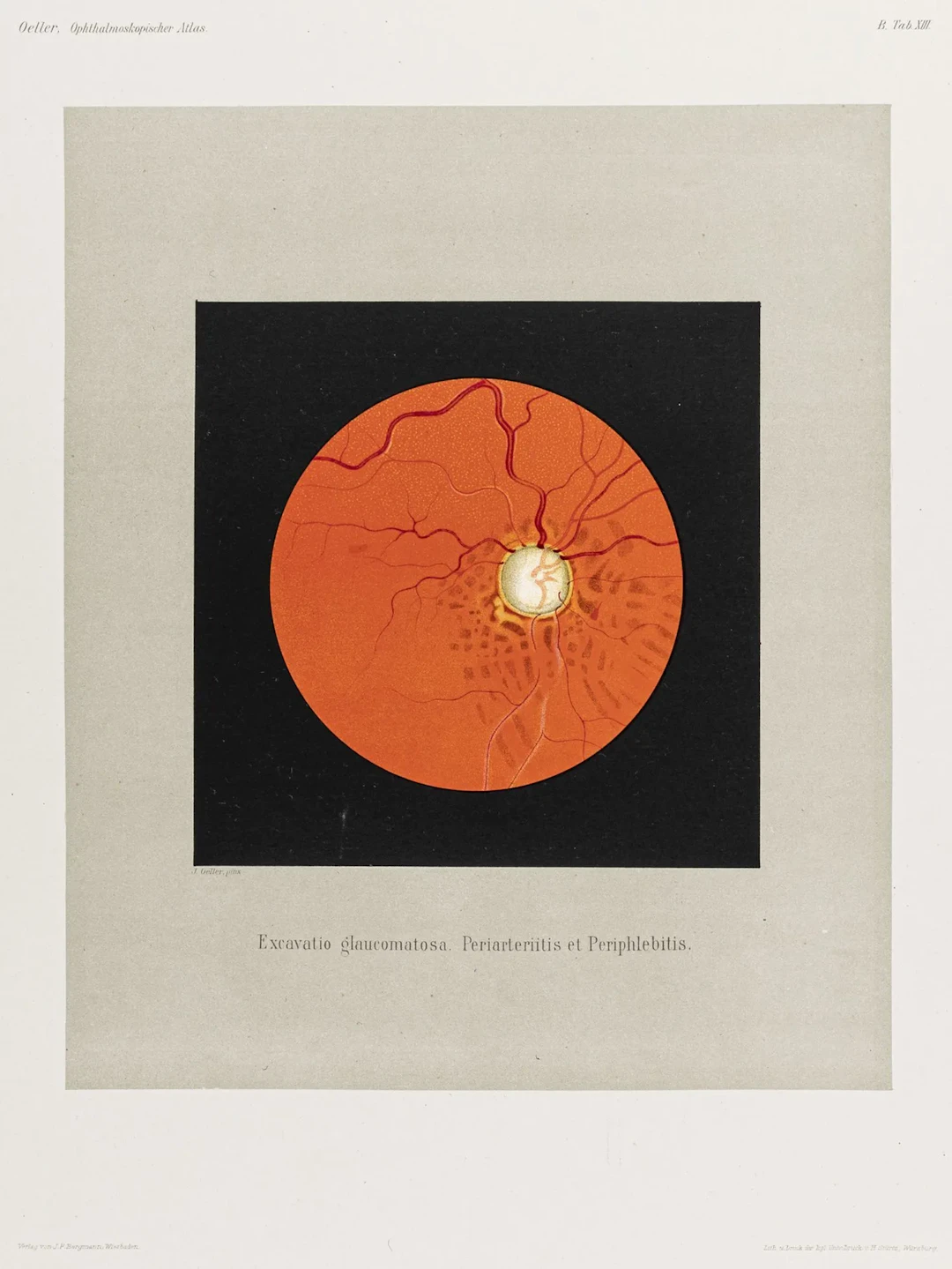 Medizin - Ophthalmologie