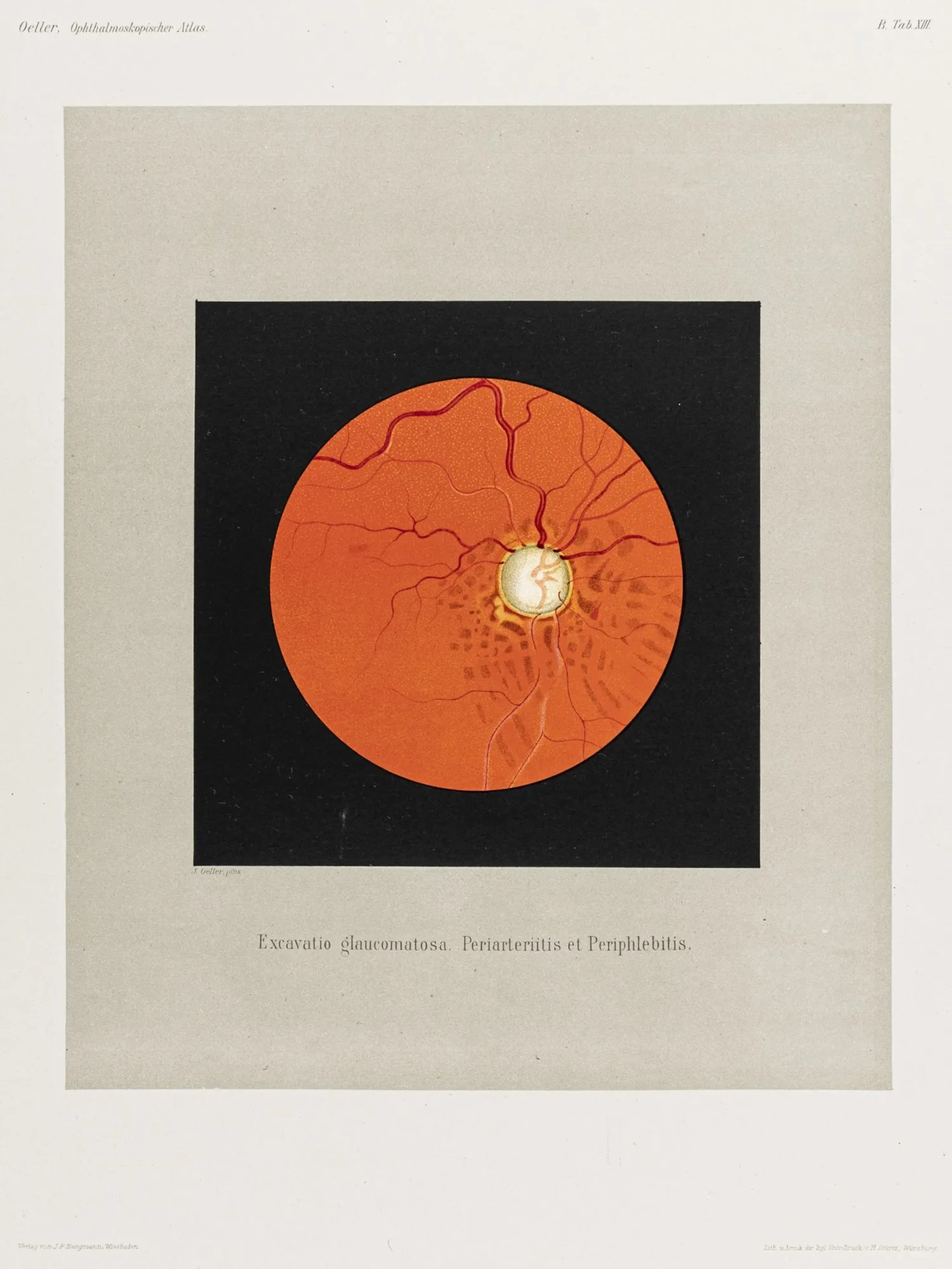 Medizin - Ophthalmologie