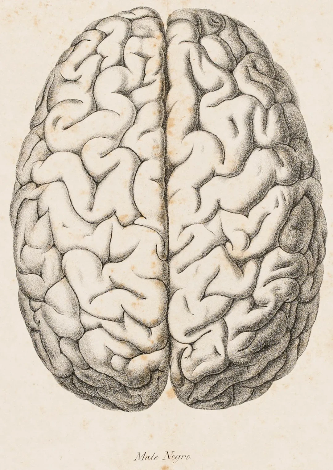 Medizin - Neurologie