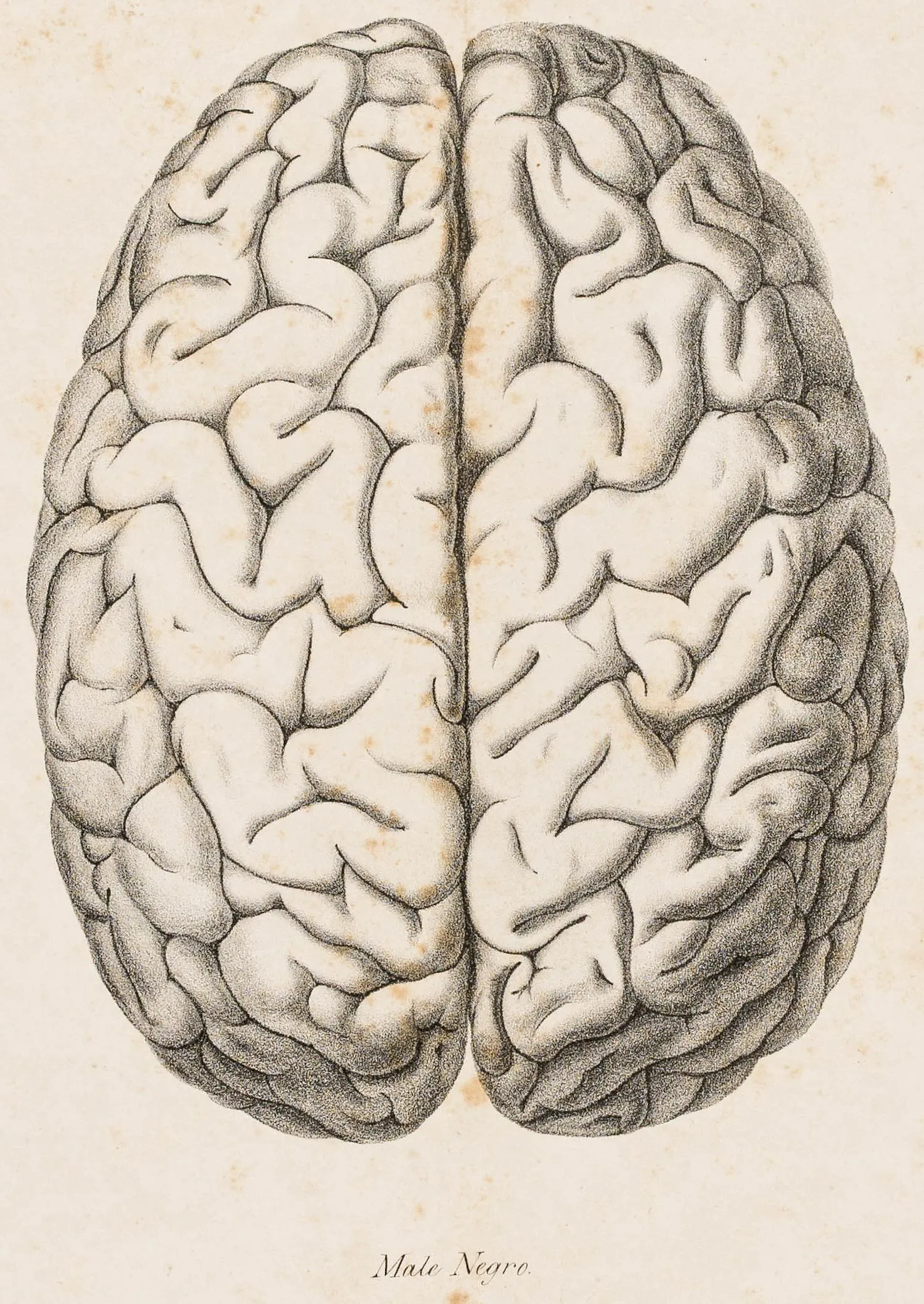 Medizin - Neurologie