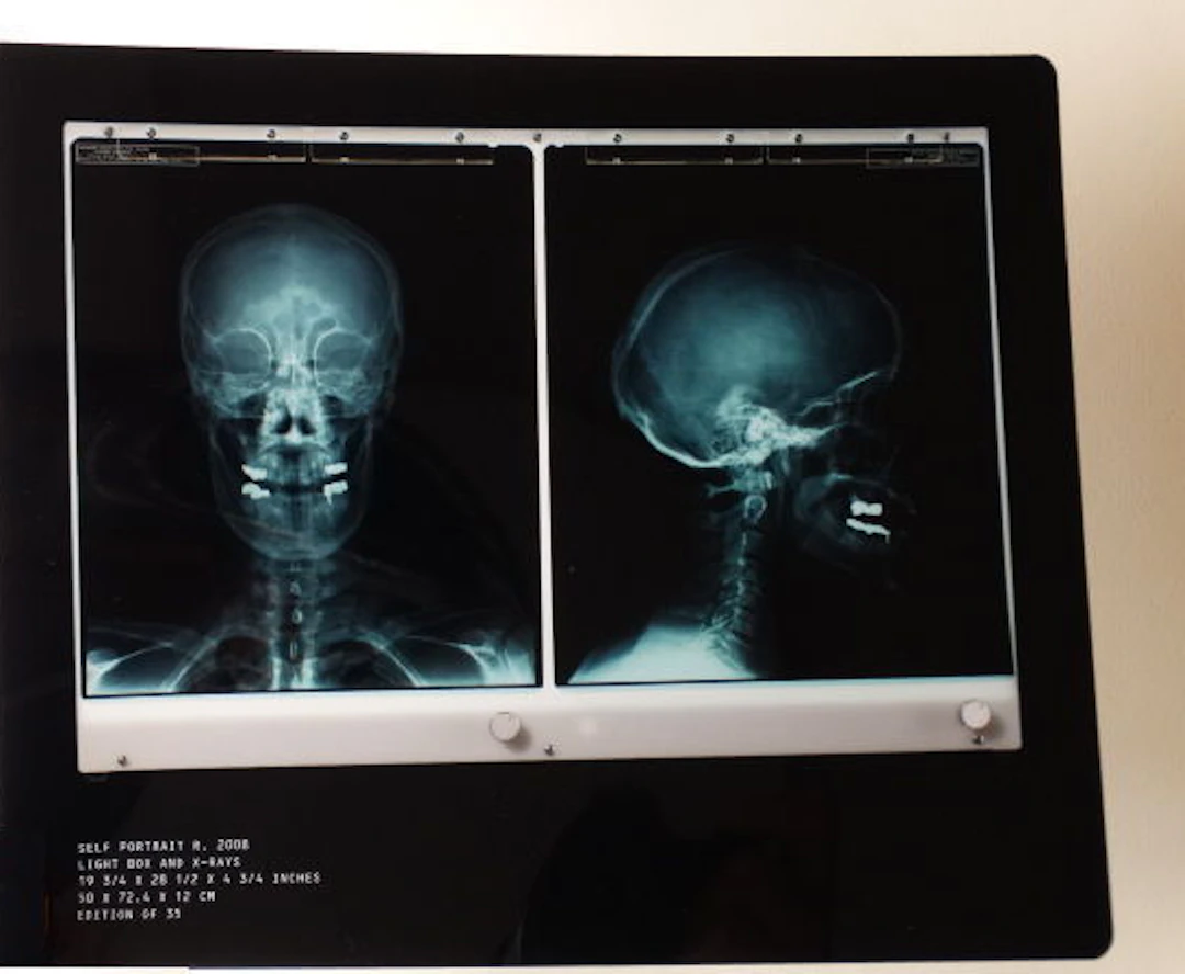 Damien Hirst - Rx Sefportrait - 2010