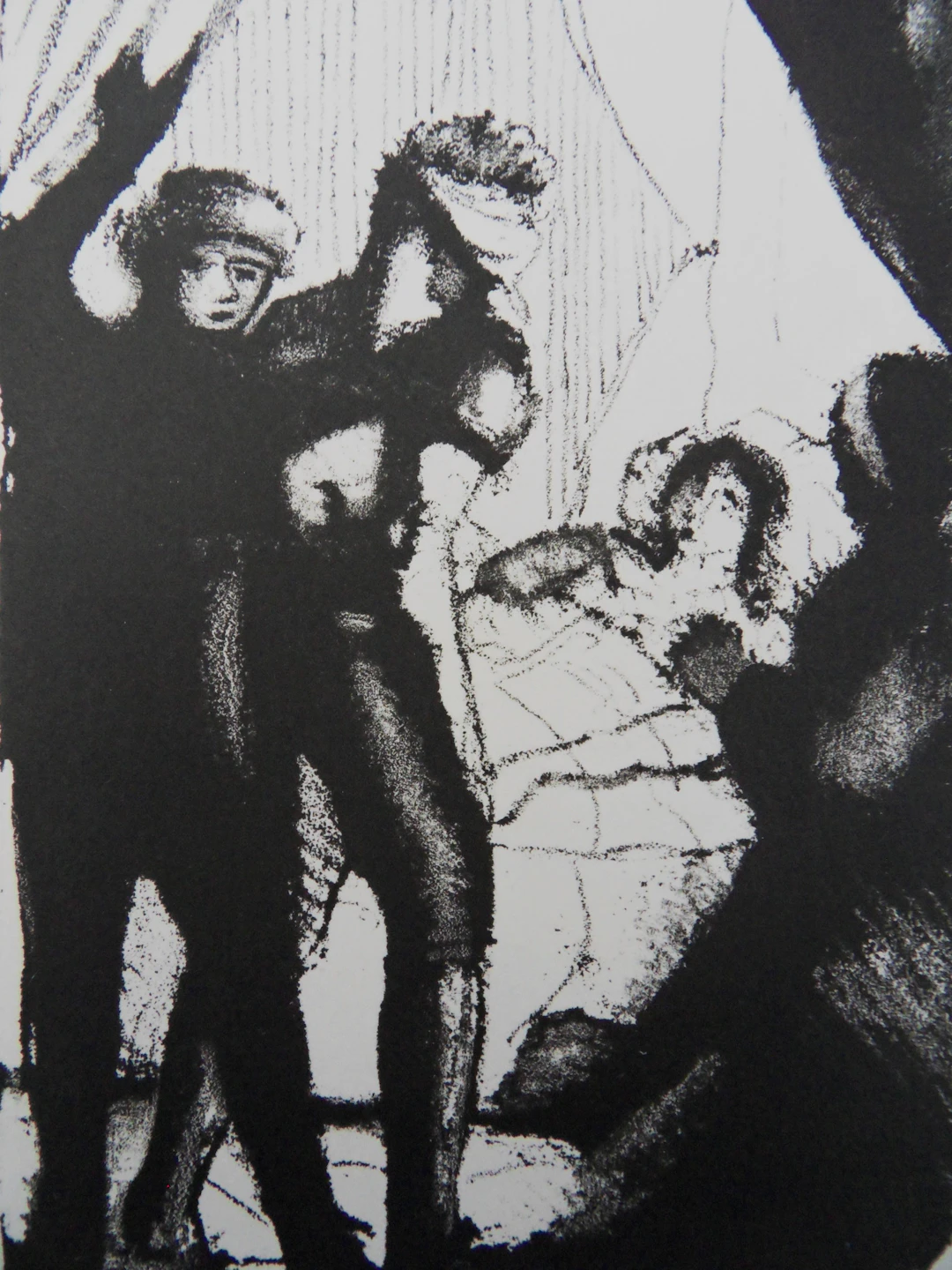 André DERAIN : La malade - Lithographie originale signée