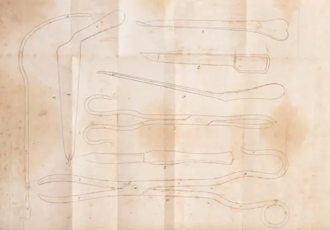 Urology & Bladder Stones.- Thomson (John) Observations on lithotomy