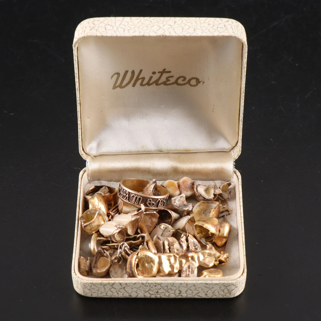 Scrap Gold Collection Featuring Gold Cavity Fillings and Other Novelties