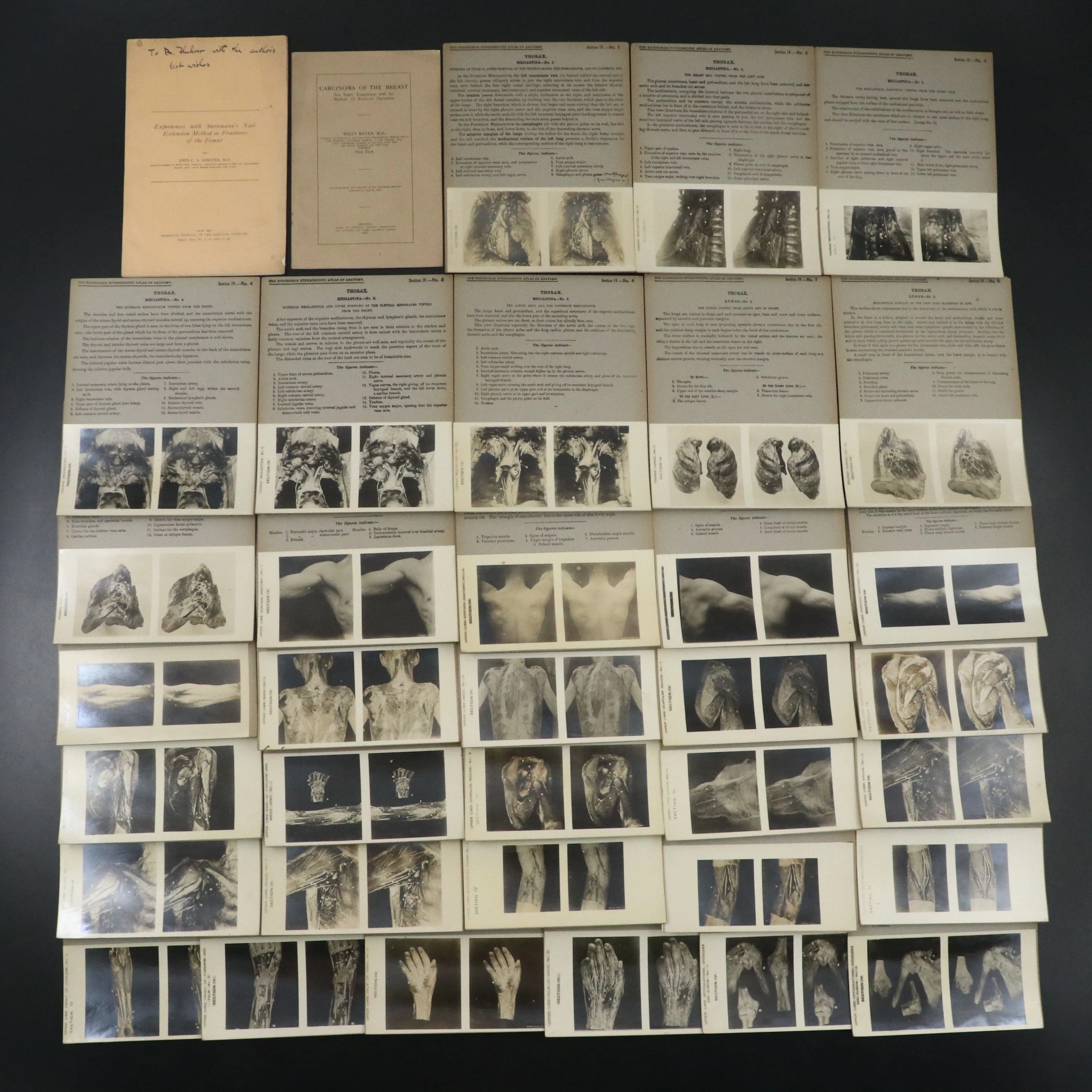 Medical Anatomy Stereoscopic Cards and Booklets, Early 20th Century