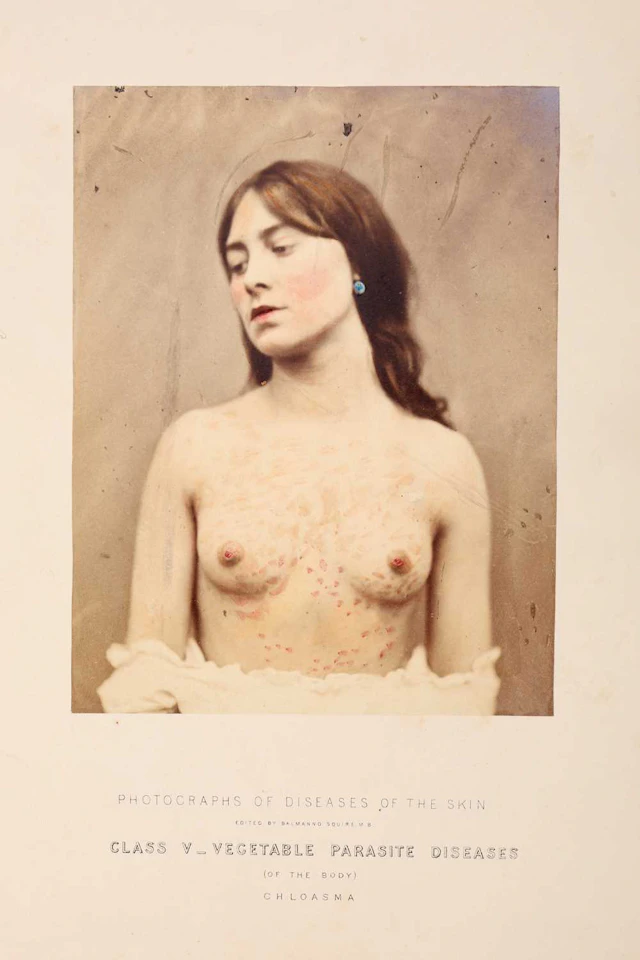 Squire, Alexander Balmanno, Photographs (Colored from Life) of the