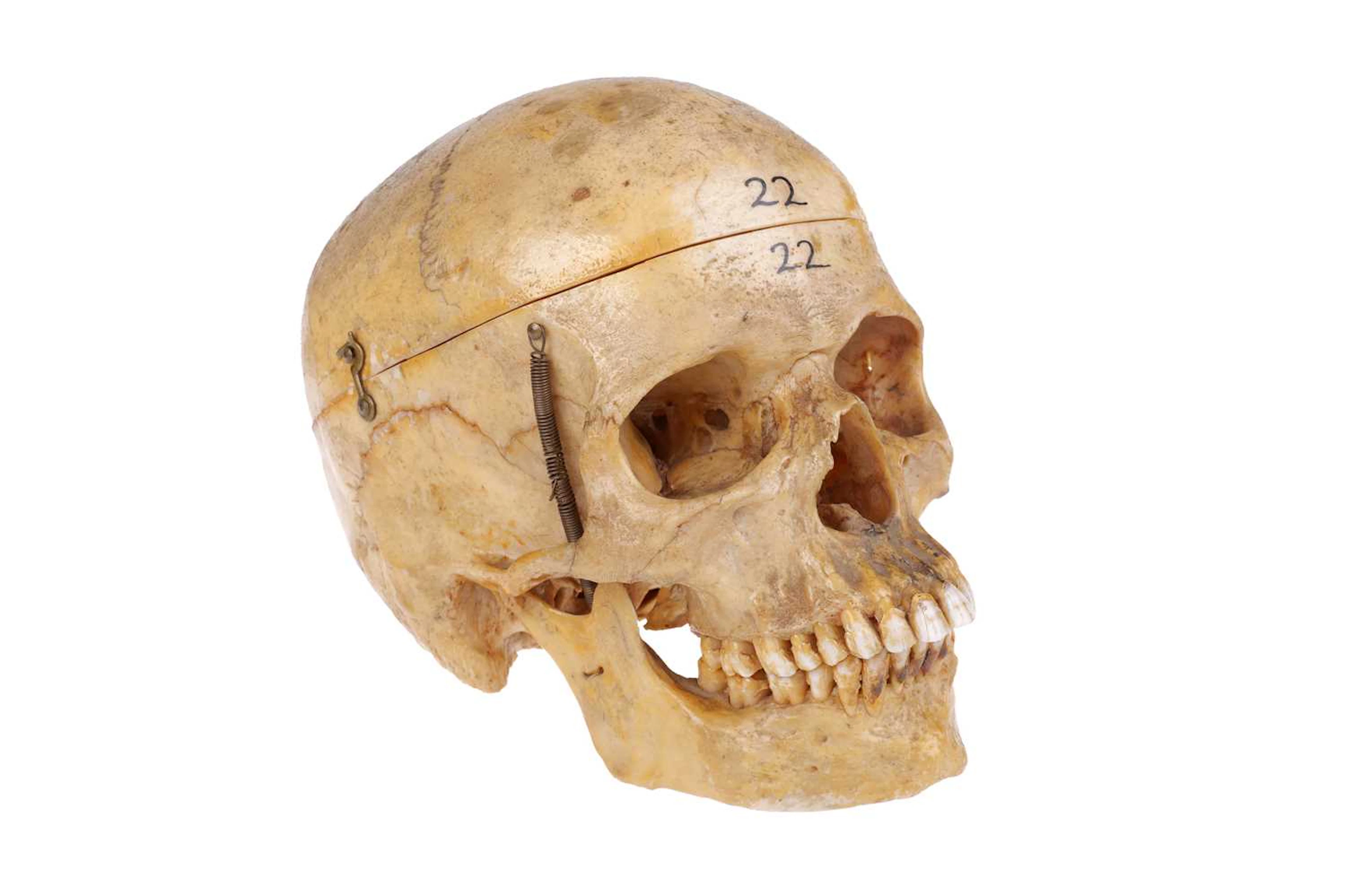Victorian Anatomical Human Skull