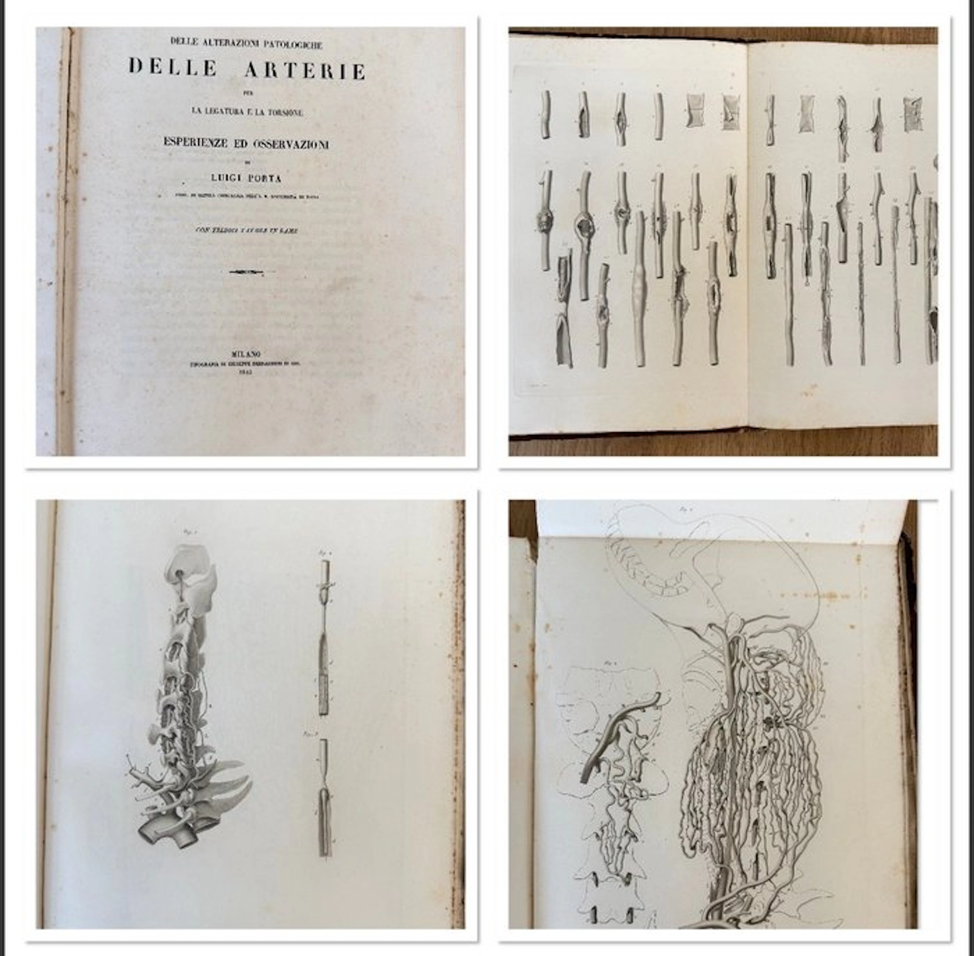 Luigi Porta - Delle alterazioni patologiche delle Arterie - 1845