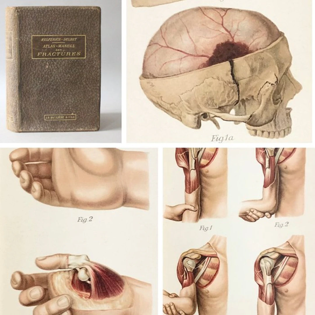 Heinrich Helferich - Atlas-manuel des fractures et luxations - 1901