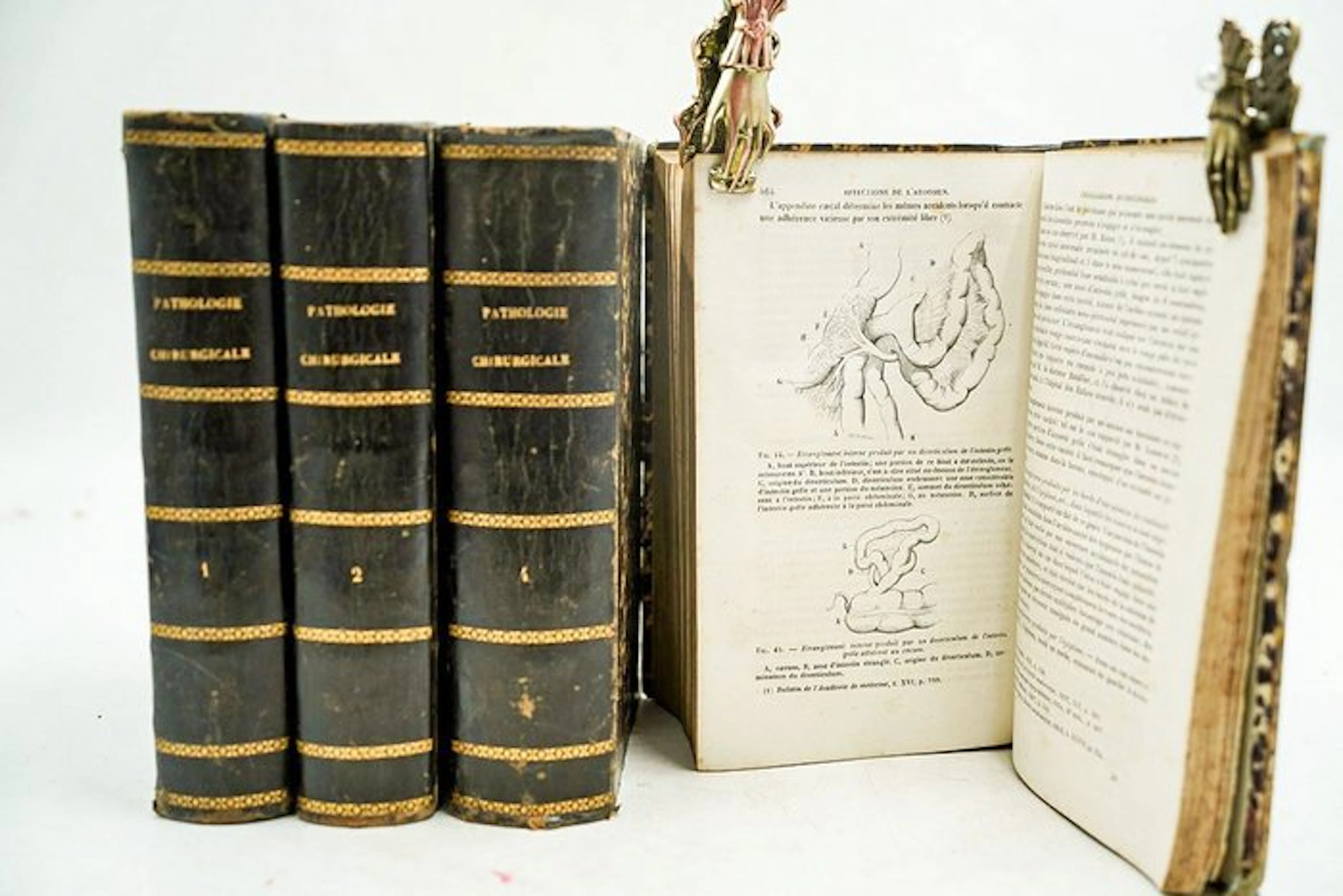A. Nélaton - Élémens de Pathologie Chirurgicale - 1844-1859