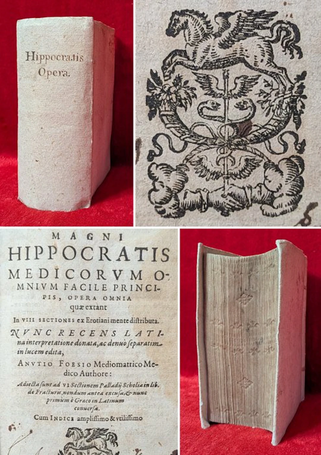 Hippocrates - Hippocratis Opera [FIRST EDITION WITH "LIBRI DE FRACTURIS"]