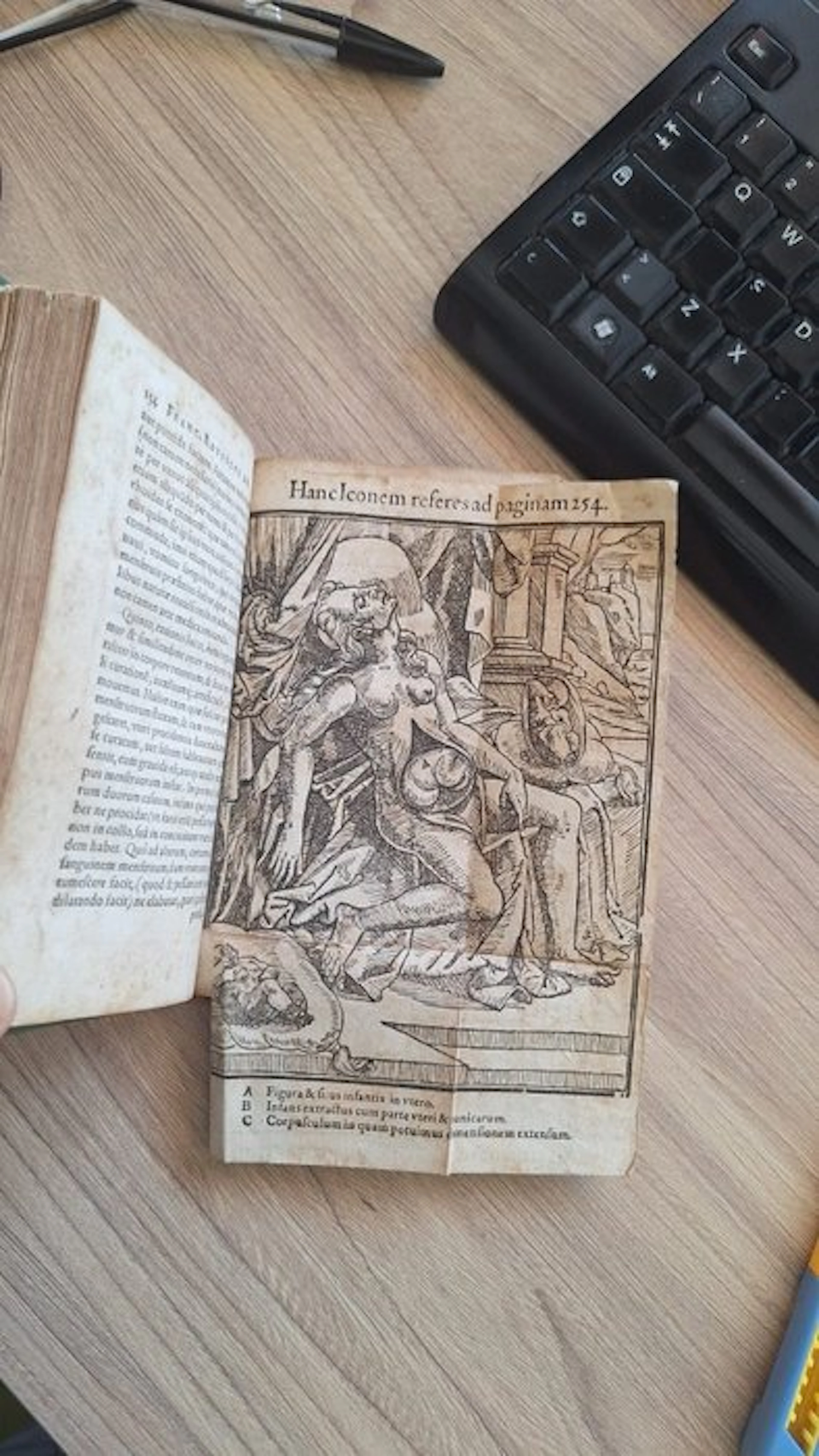 Francisci Rousseti - ΥΣΤΕΡΟΤΟΜΟΤΟΚΙΑ [Hysterotomotokia] - 1588