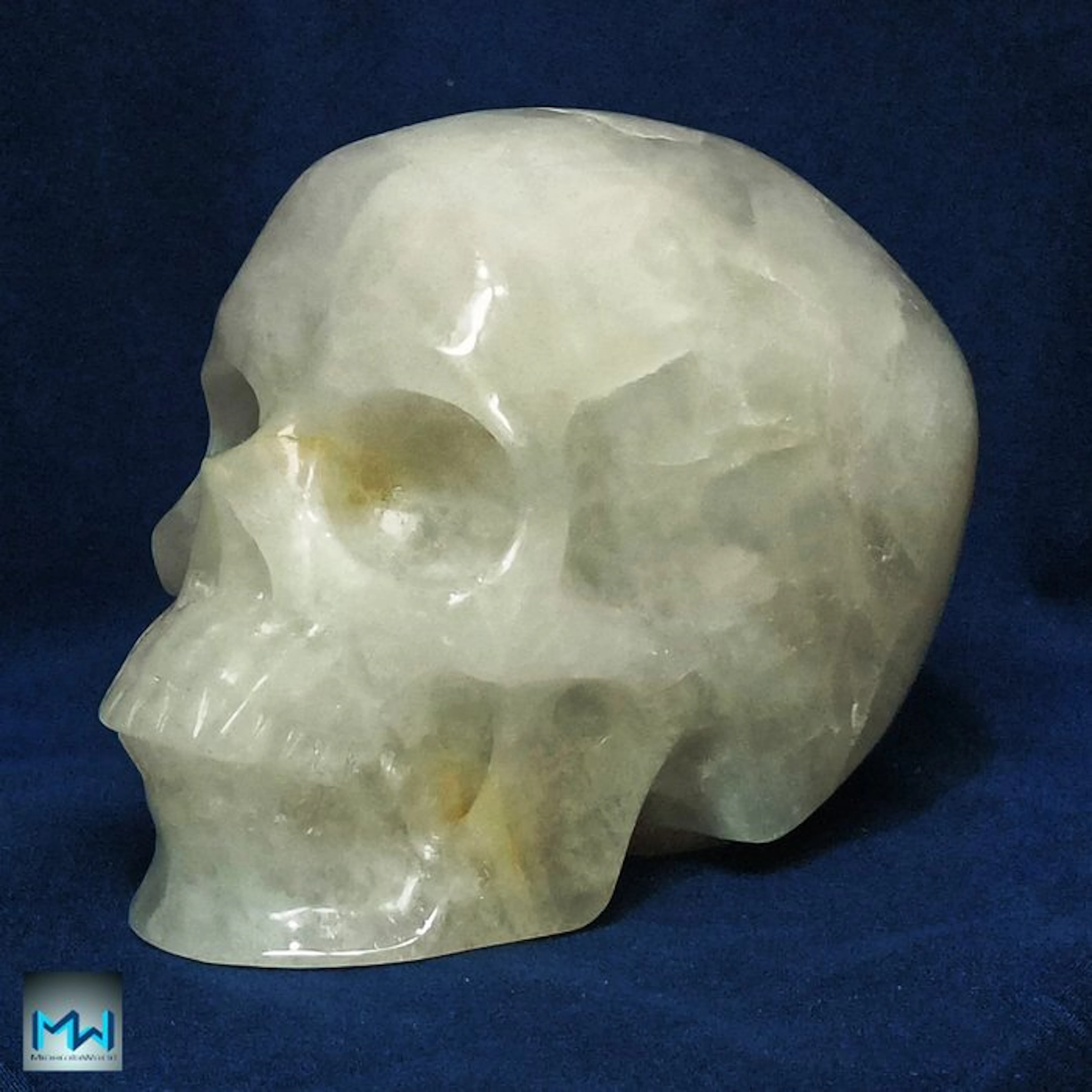 Human Skull