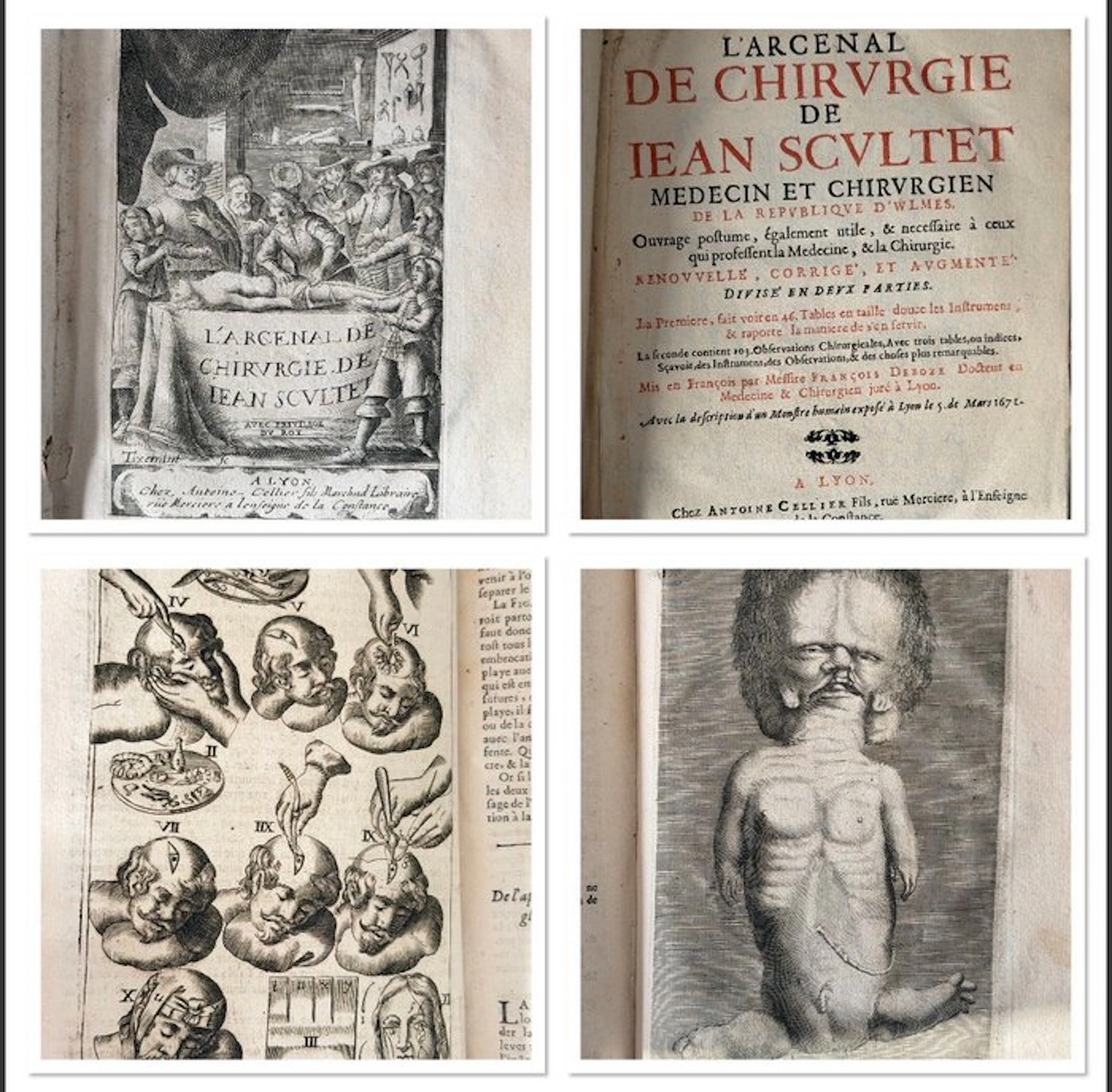 Jean Scultet - L’Arcenal de chirurgie - 1685