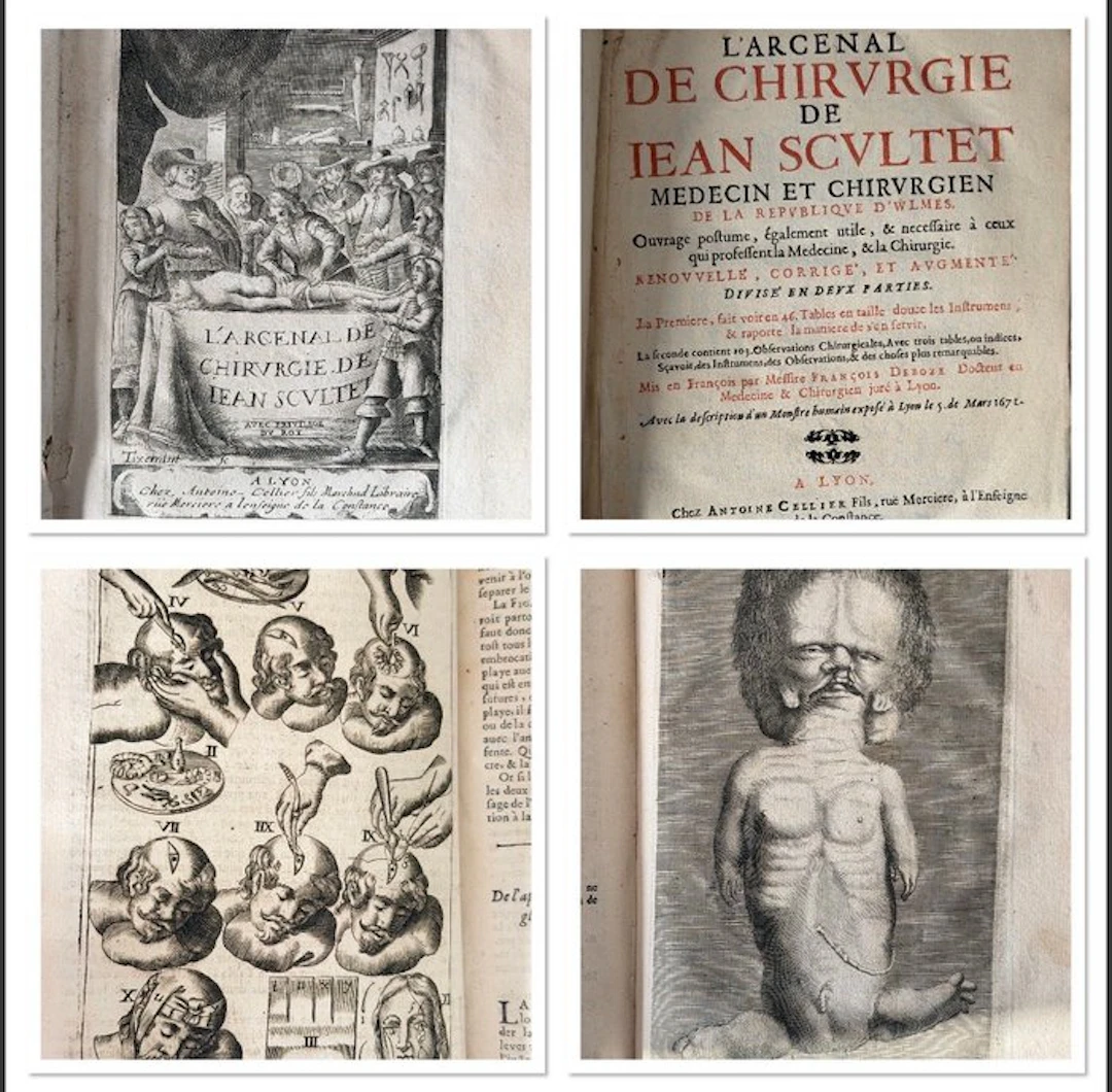 Jean Scultet - L’Arcenal de chirurgie - 1685
