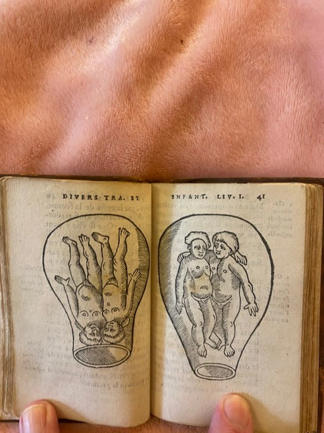 Eucharius Rösslin - Des divers travaux et enfantemens des femmes... - 1584
