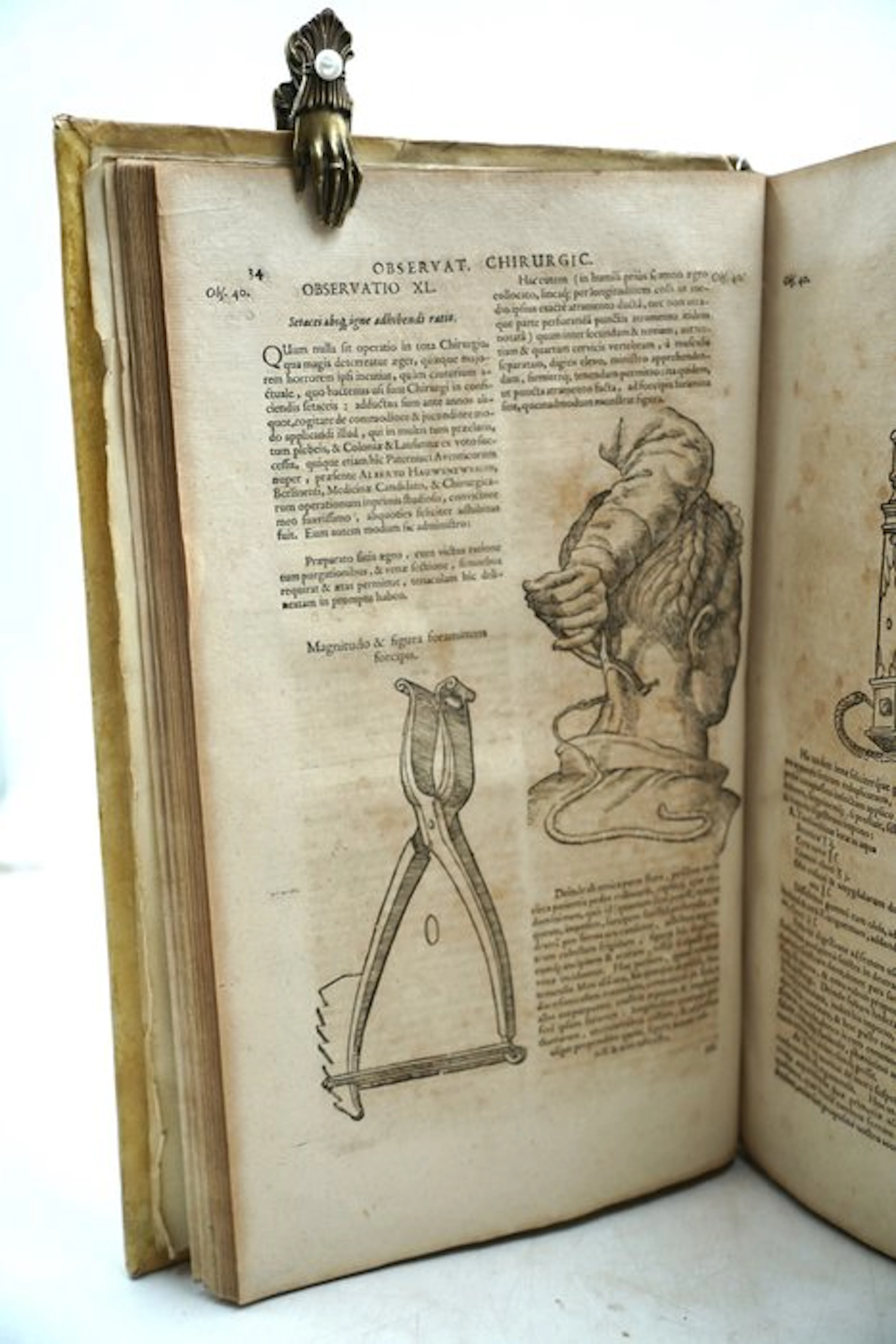 Guilielmus Fabricius Hildanus - Opera quae extant omnia