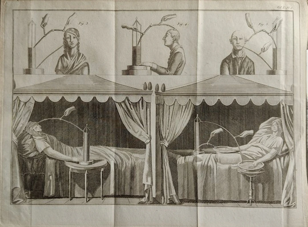 Giovanni Aldini [Jean Aldini] - Essai théorique et...