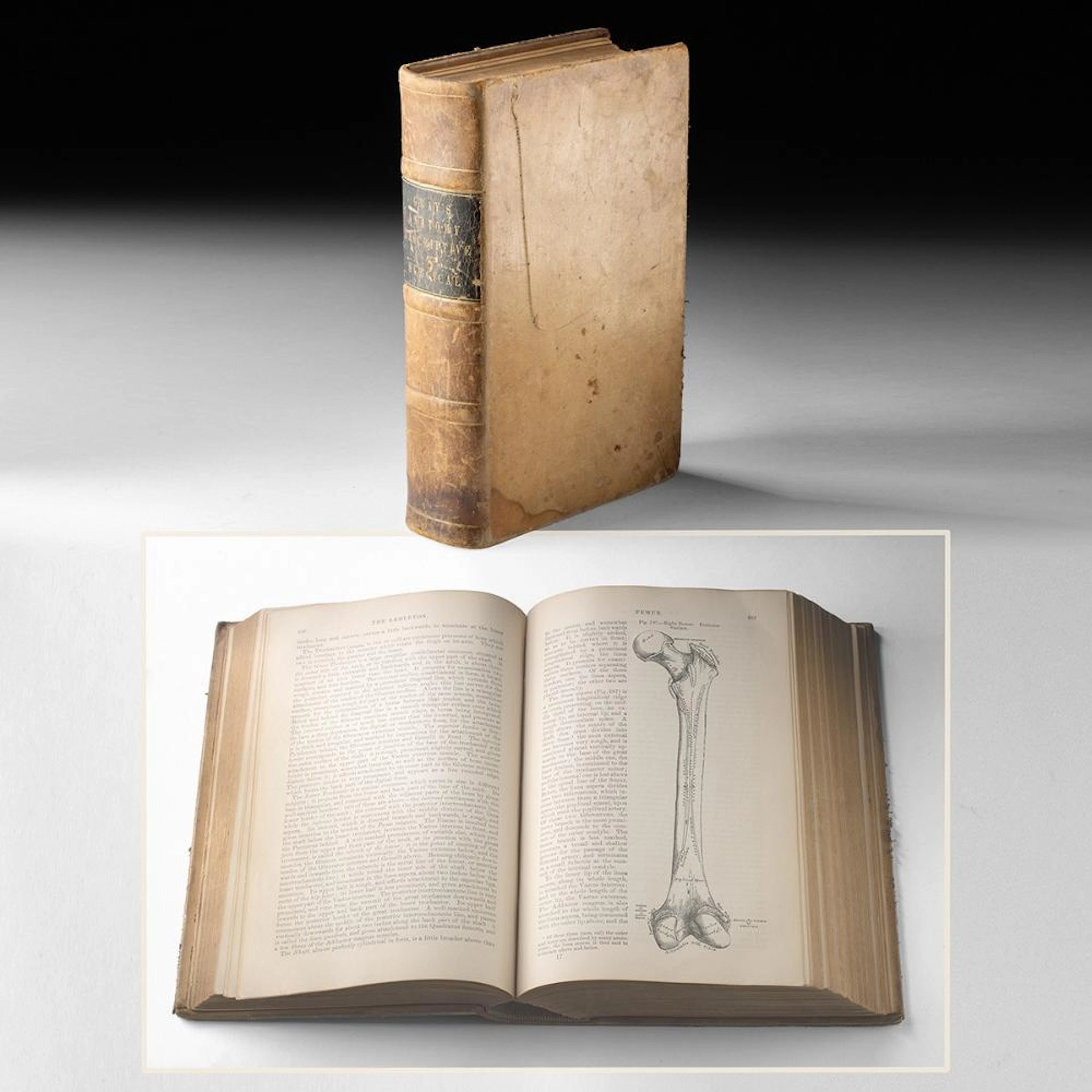 Gray's Anatomy, Descriptive and Surgical, 1878 Henry C. Lea Philadelphia