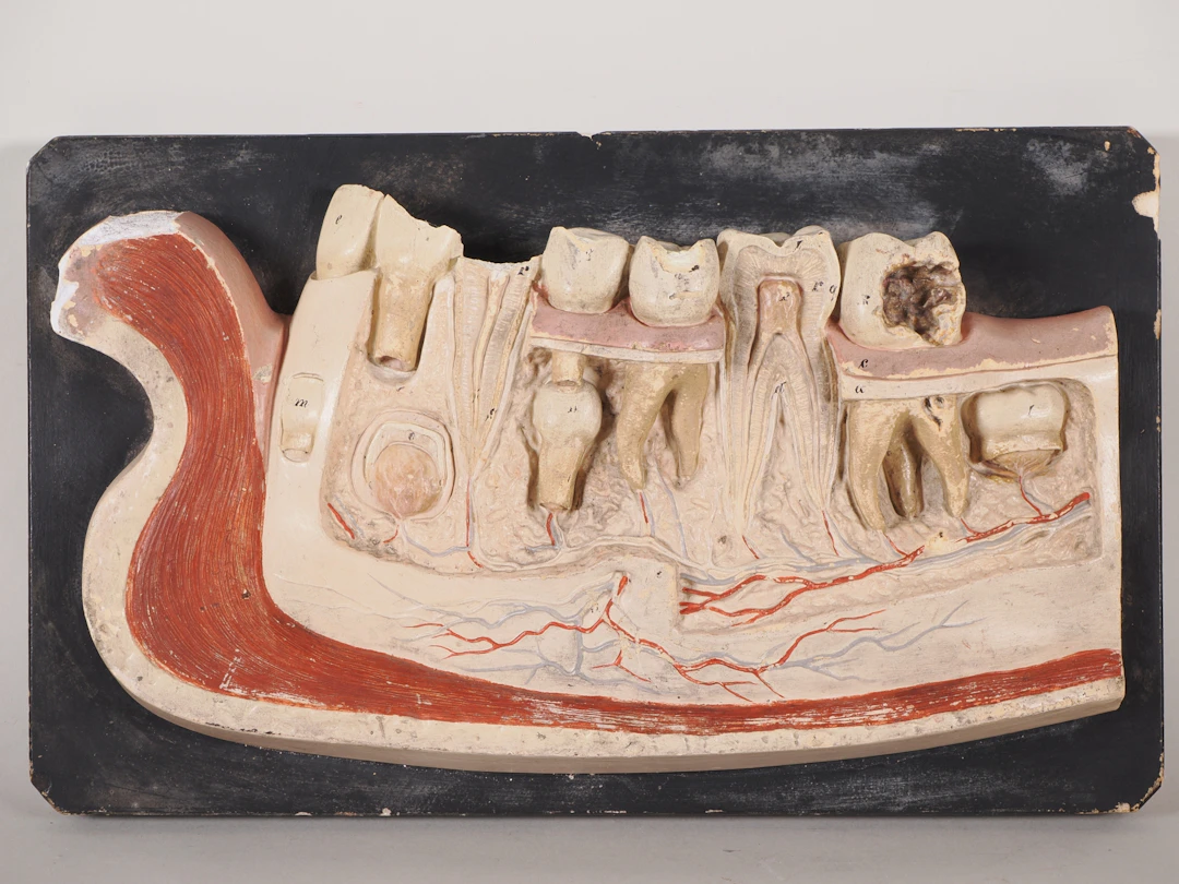 Los 1510: C.A. Lorenz Leipzig, anatomisches Unterkiefer-Modell um 1900