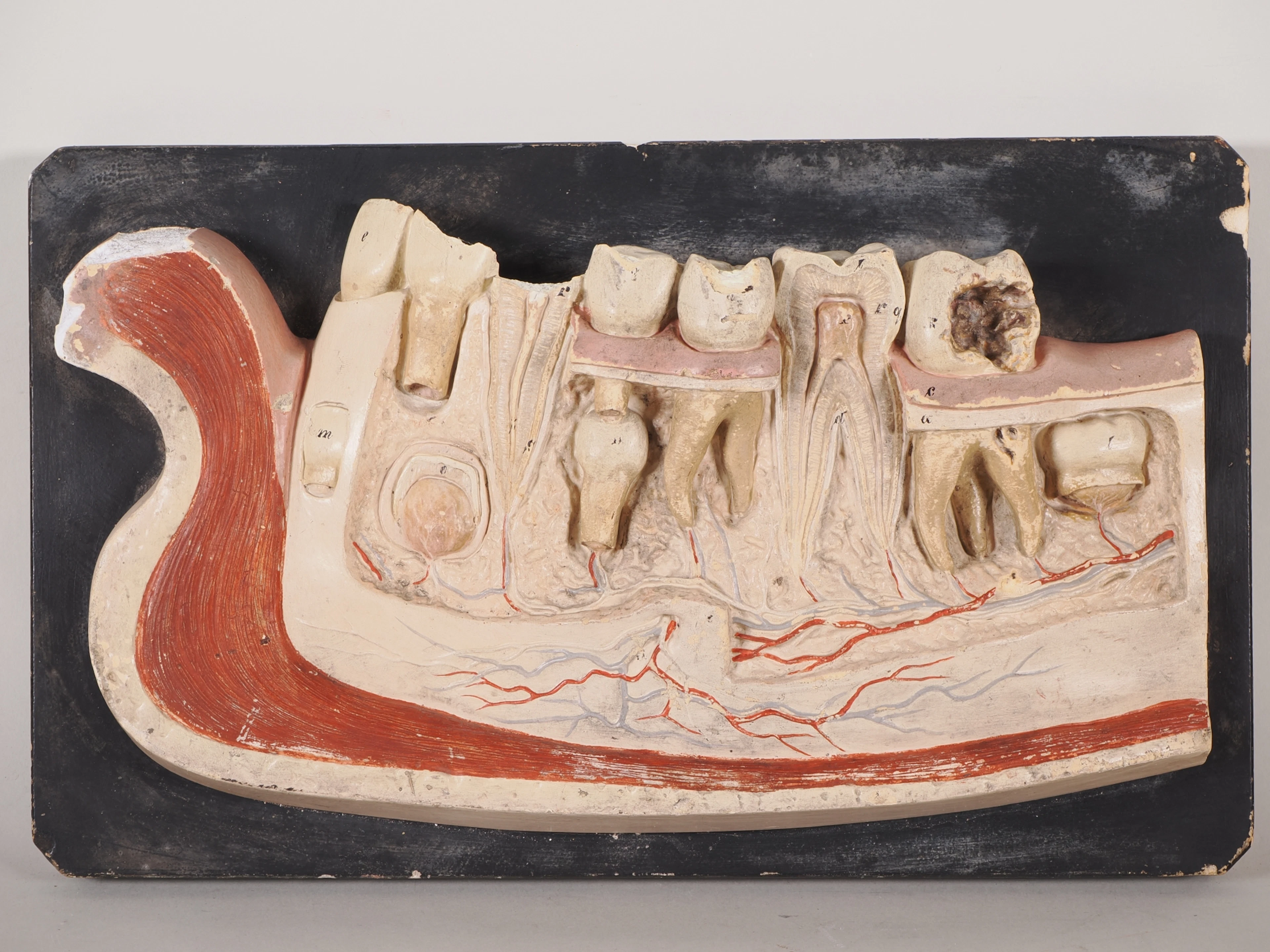 Los 1510: C.A. Lorenz Leipzig, anatomisches Unterkiefer-Modell um 1900