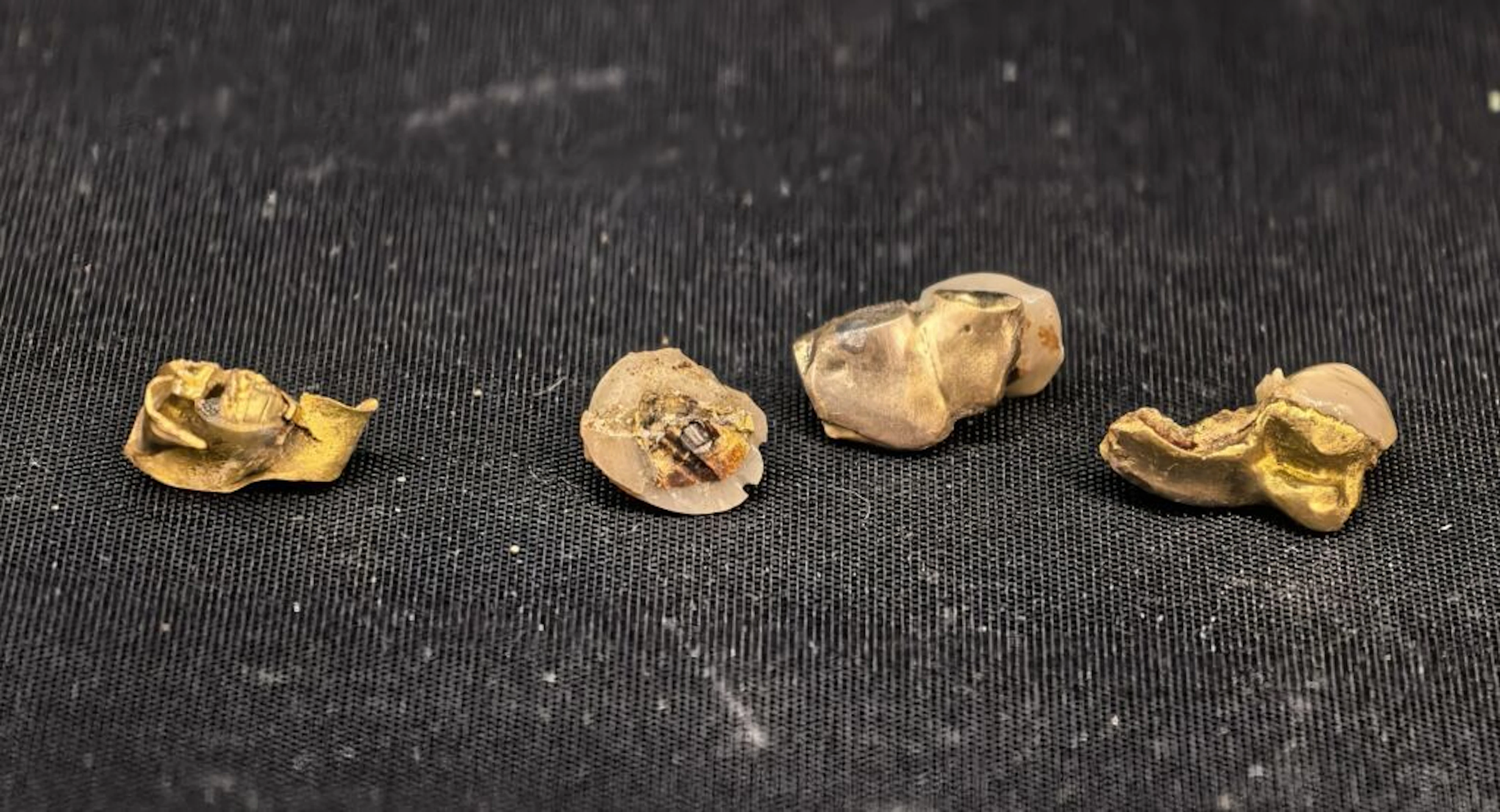 Dental gold. Net weight: 1.3 g (hollow tooth); Gross weight: 6.9 g