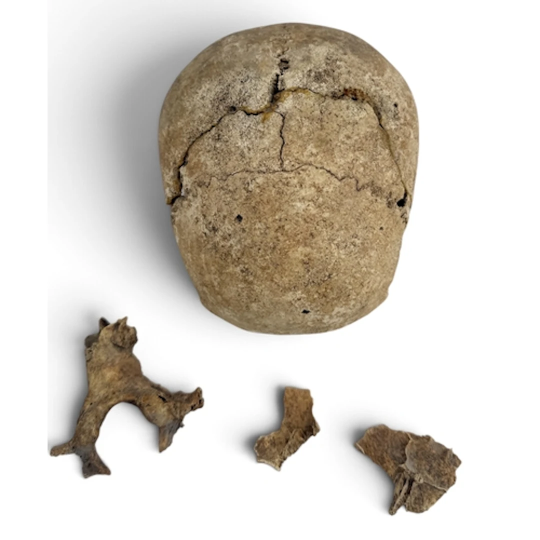 A PARTIAL HUMAN SKULL, POSSIBLY ANCIENT ROMAN Discovered dur...