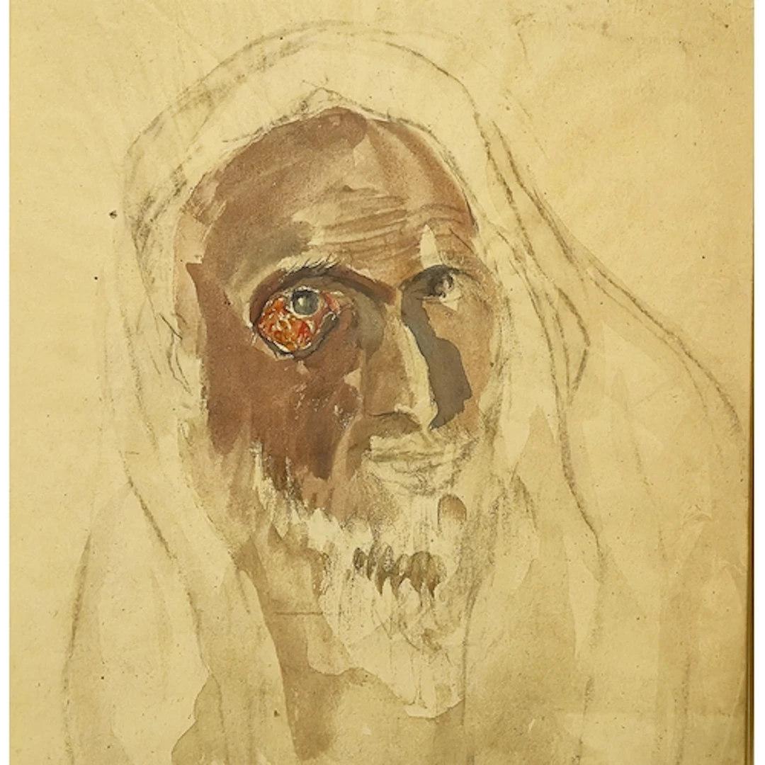 UNKNOWN ARTIST, 19th Century. Medical Illustration of an Eld...