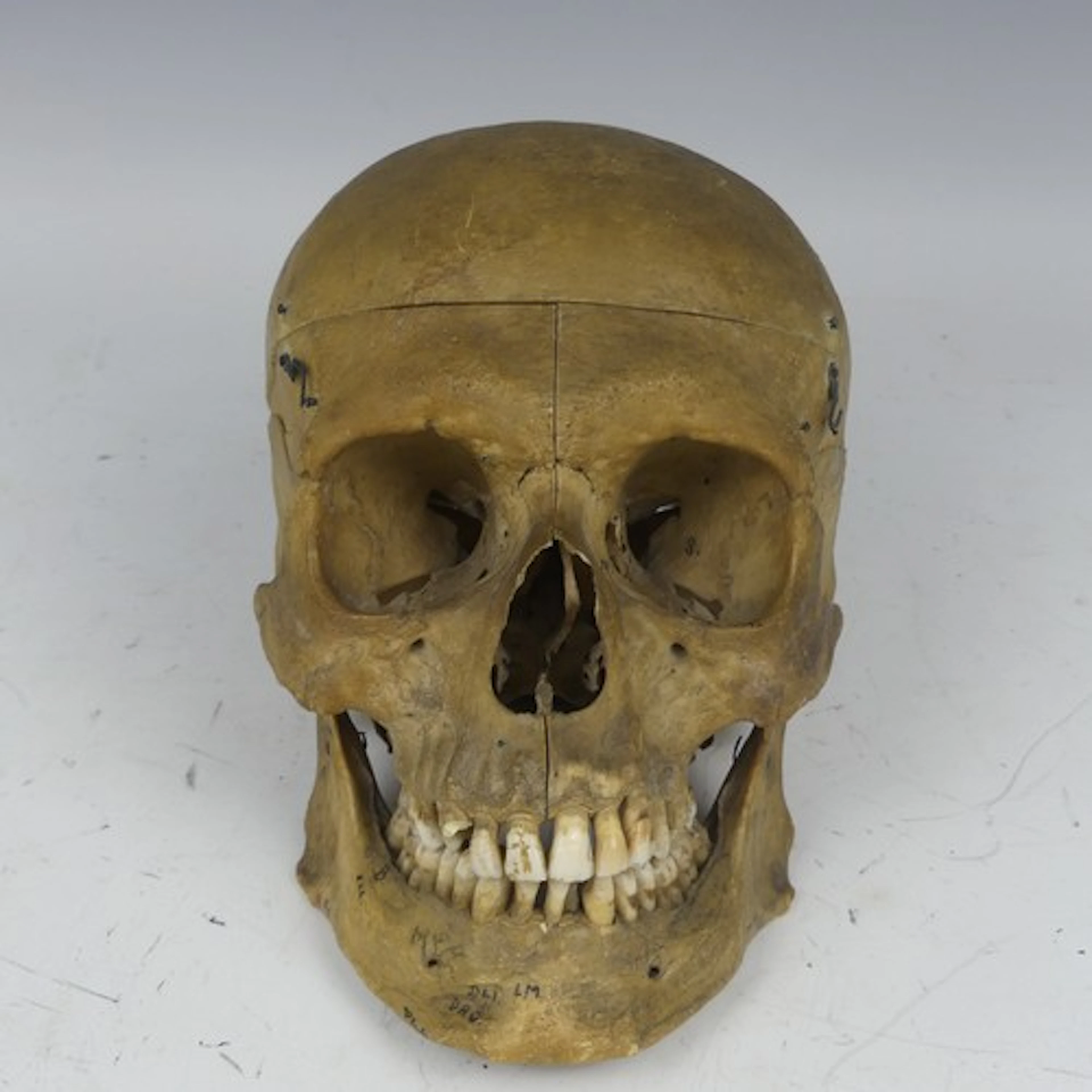 An antique Anatomical medical student's Human Skull, used fo...