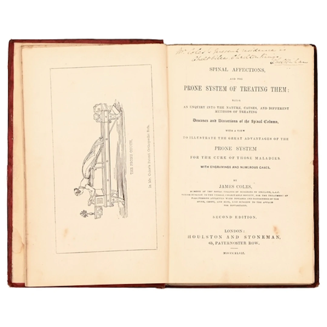 Medical. Coles (James, MRCS), Spinal Affections, and the Pro...