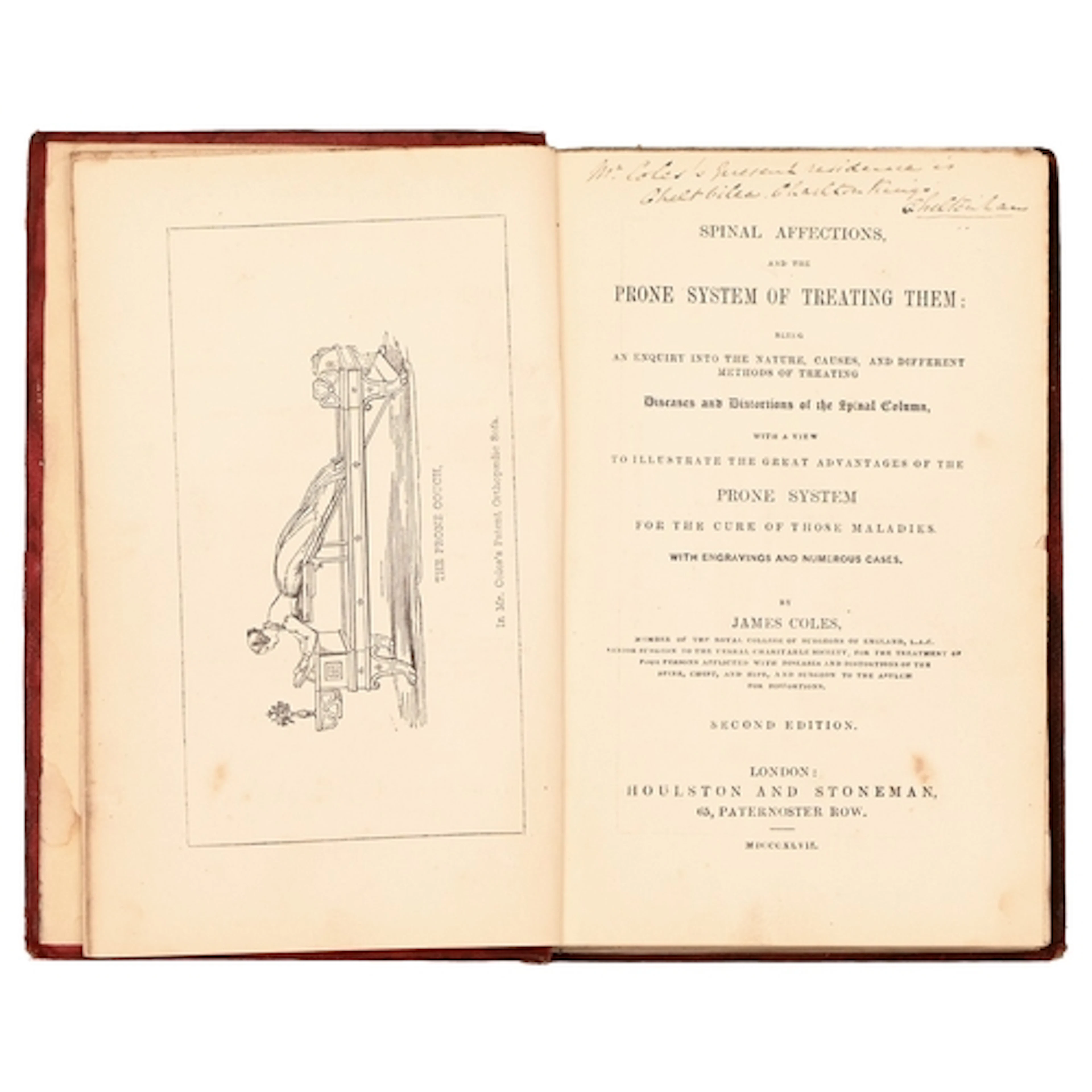 Medical. Coles (James, MRCS), Spinal Affections, and the Pro...