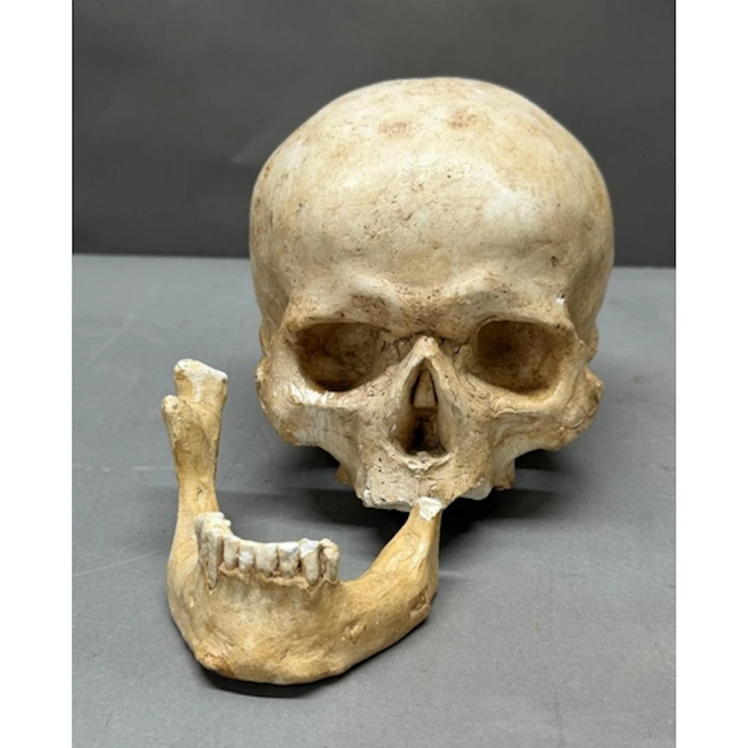 An anatomically model of a skull AF