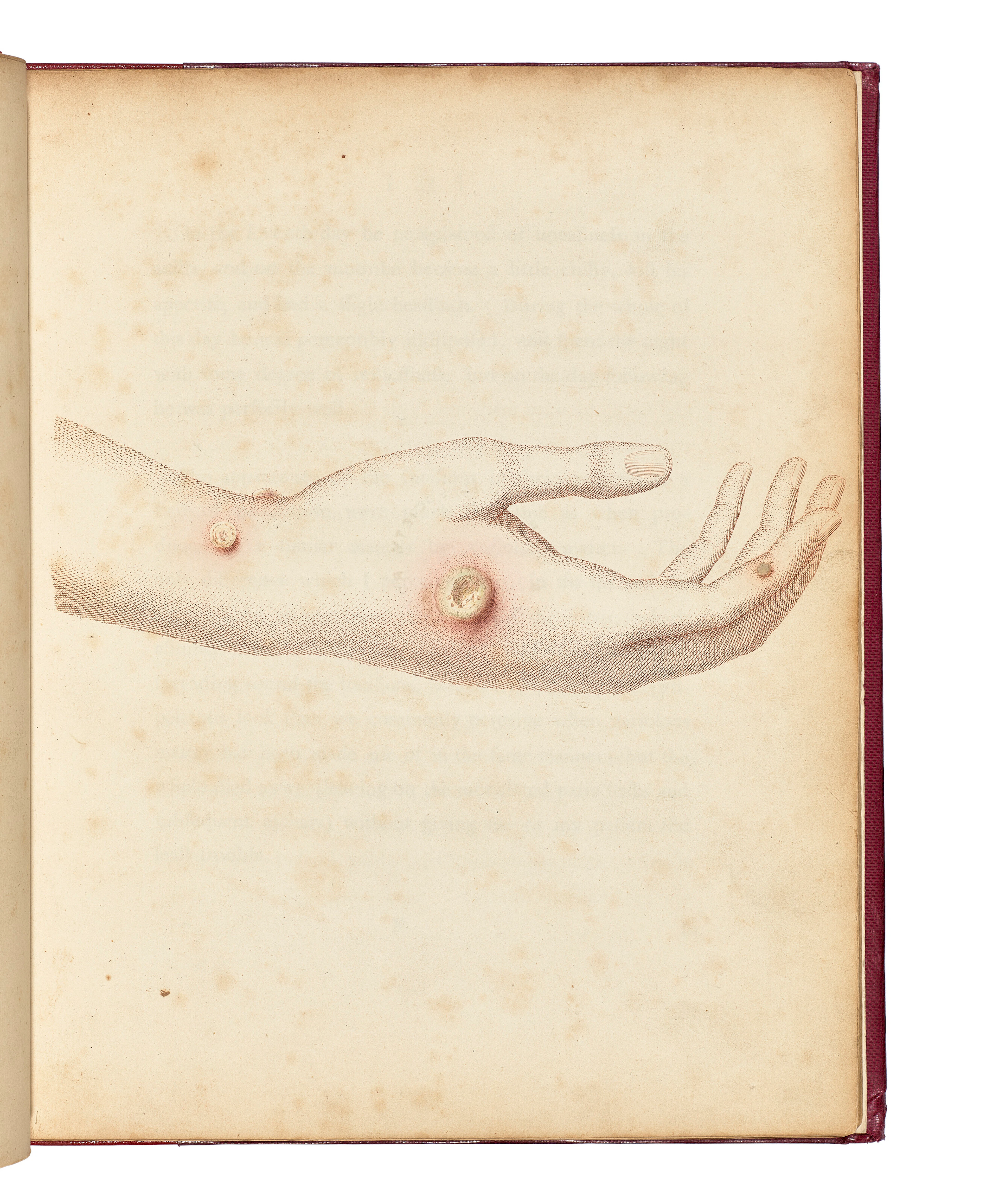 JENNER, Edward (1749-1823)