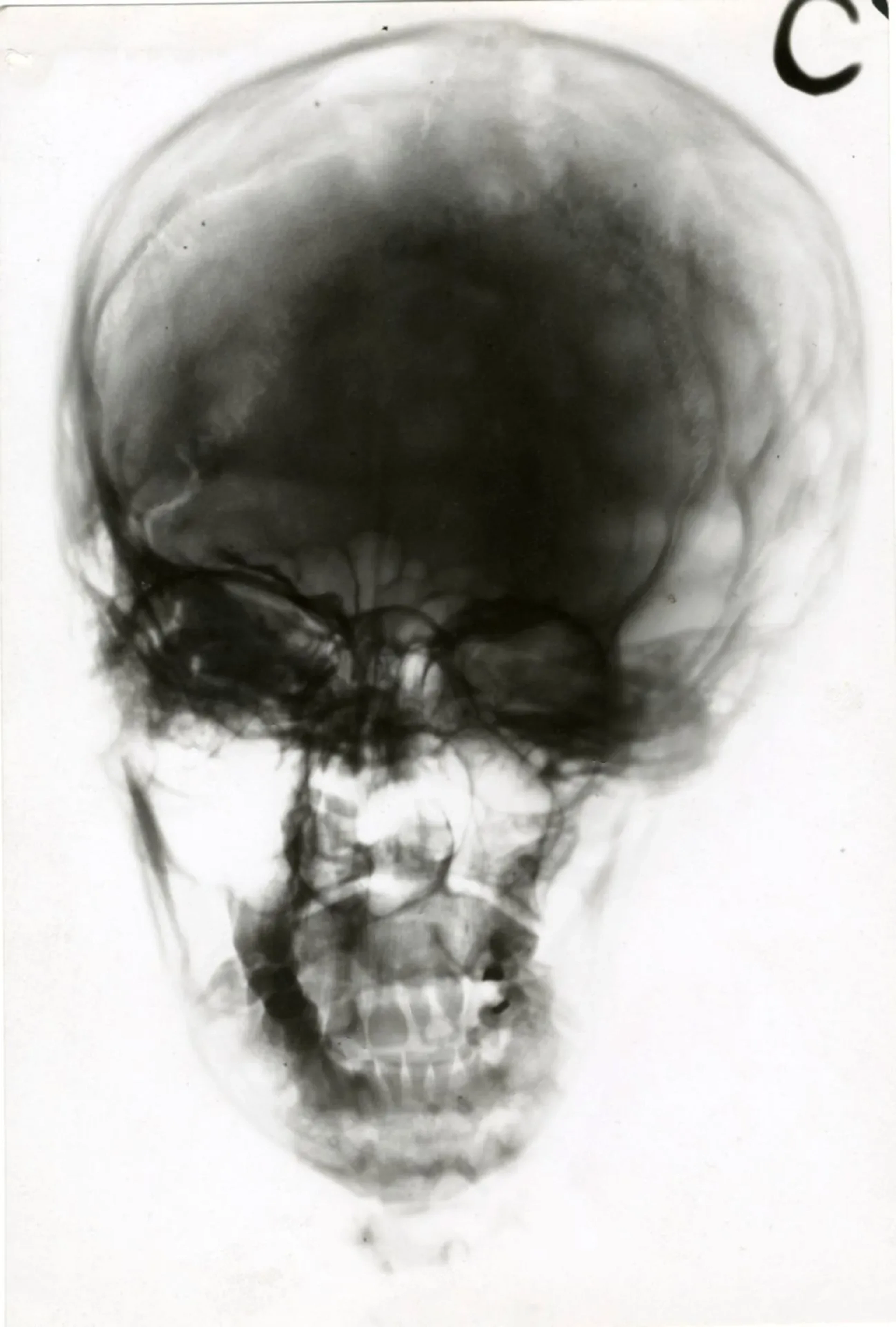 X-ray of a Skull - Lot 22