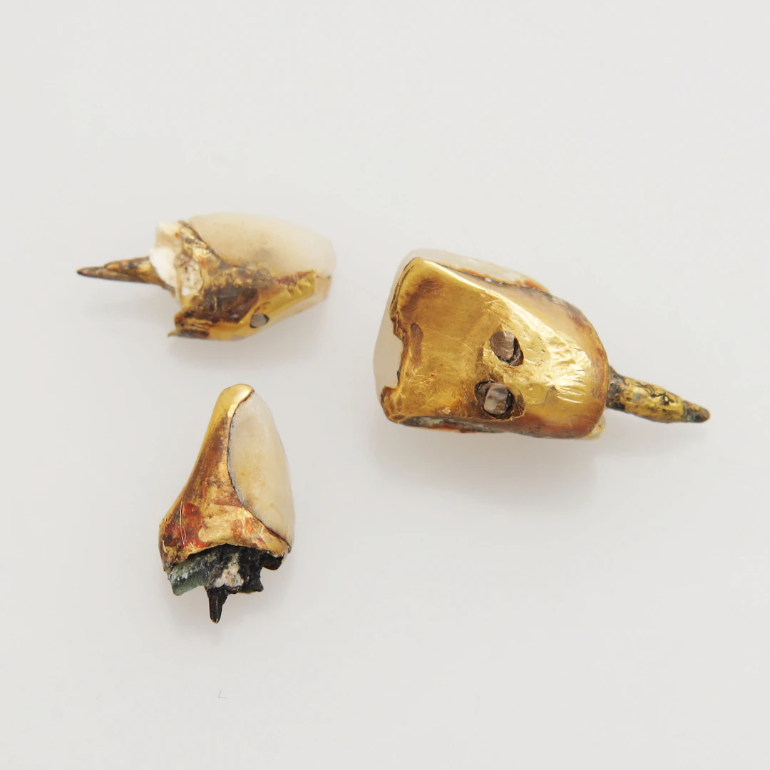 TANDGULD, vikt 4,71 gram.