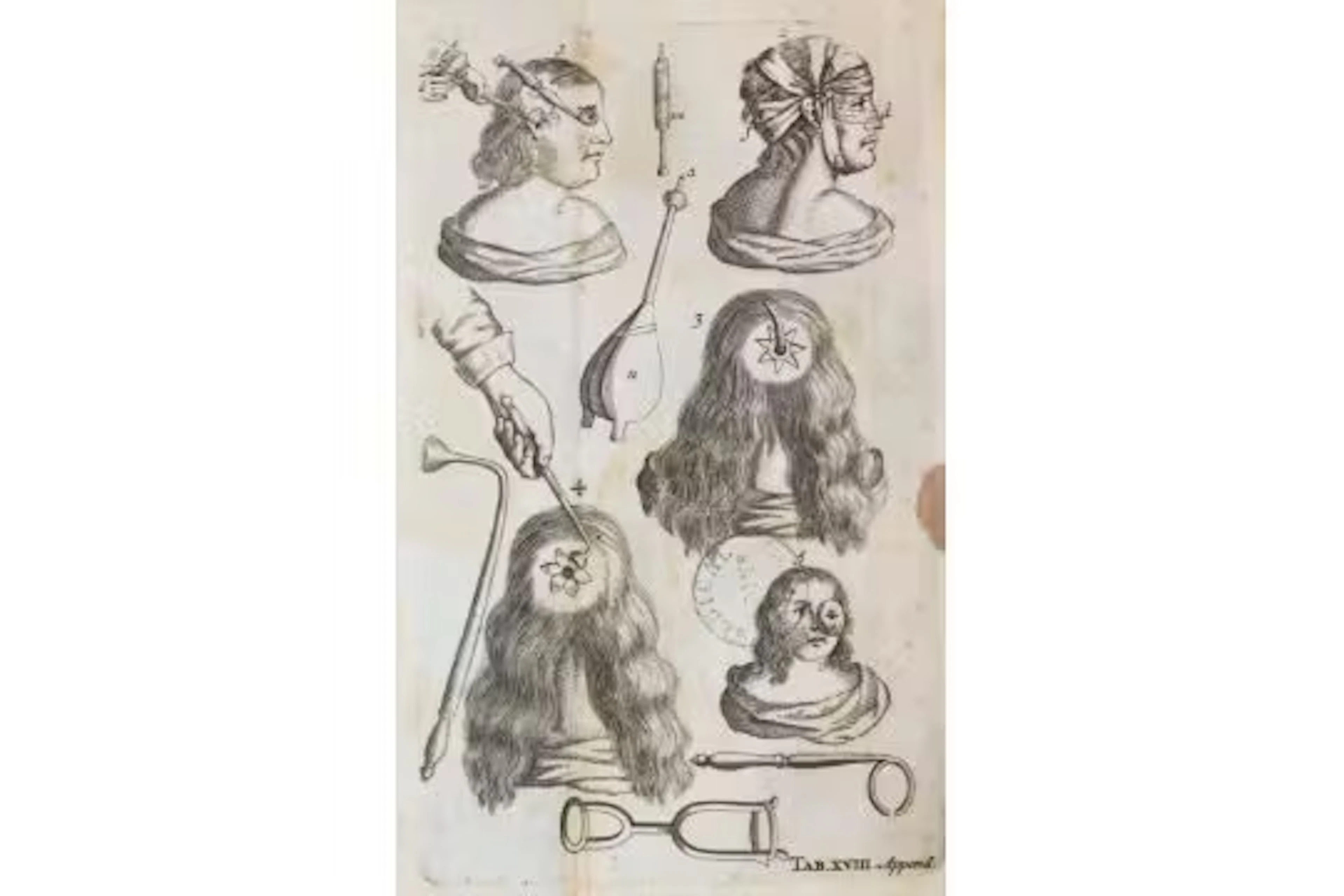 Scultetus (Schultes),J.